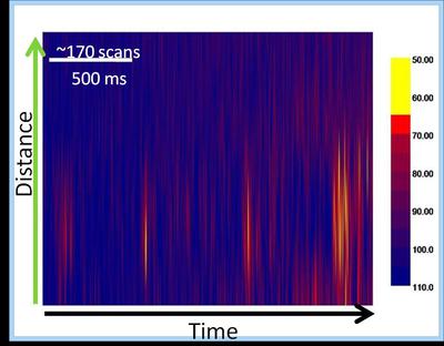 IGERT Fellow Matthew Dubachs project on detecting Sodium sparks in cardiac cells that "light up" during action potential