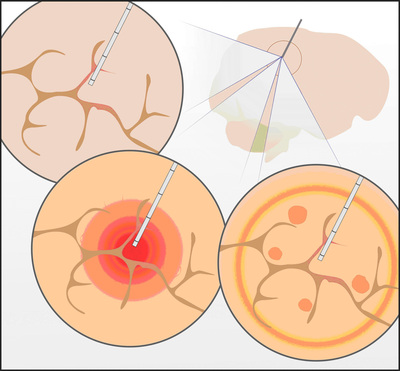 Cell Targeting