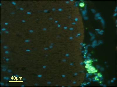 Fluorescent Tagged DNA