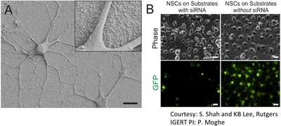 Gene Delivery to Stem Cells via Matrix-Based Nanoparticles