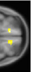 Ventrmedial Prefrontal Cortex Encodes Net Capital Gain