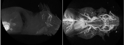 Positive Contrast from iron oxide NPs in MRI using a novel pulse sequence