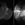 Positive Contrast from iron oxide NPs in MRI using a novel pulse sequence