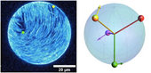 Vesicles