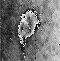 SKOV-3 Phase Image