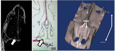 Figure 2. The vomeronasal groove (VNG) as seen in three modalities