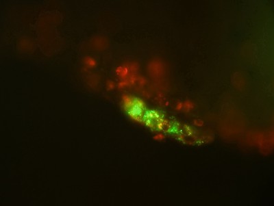 Protocells Co-localize with Activated Macrophage in the Spinal Meninges